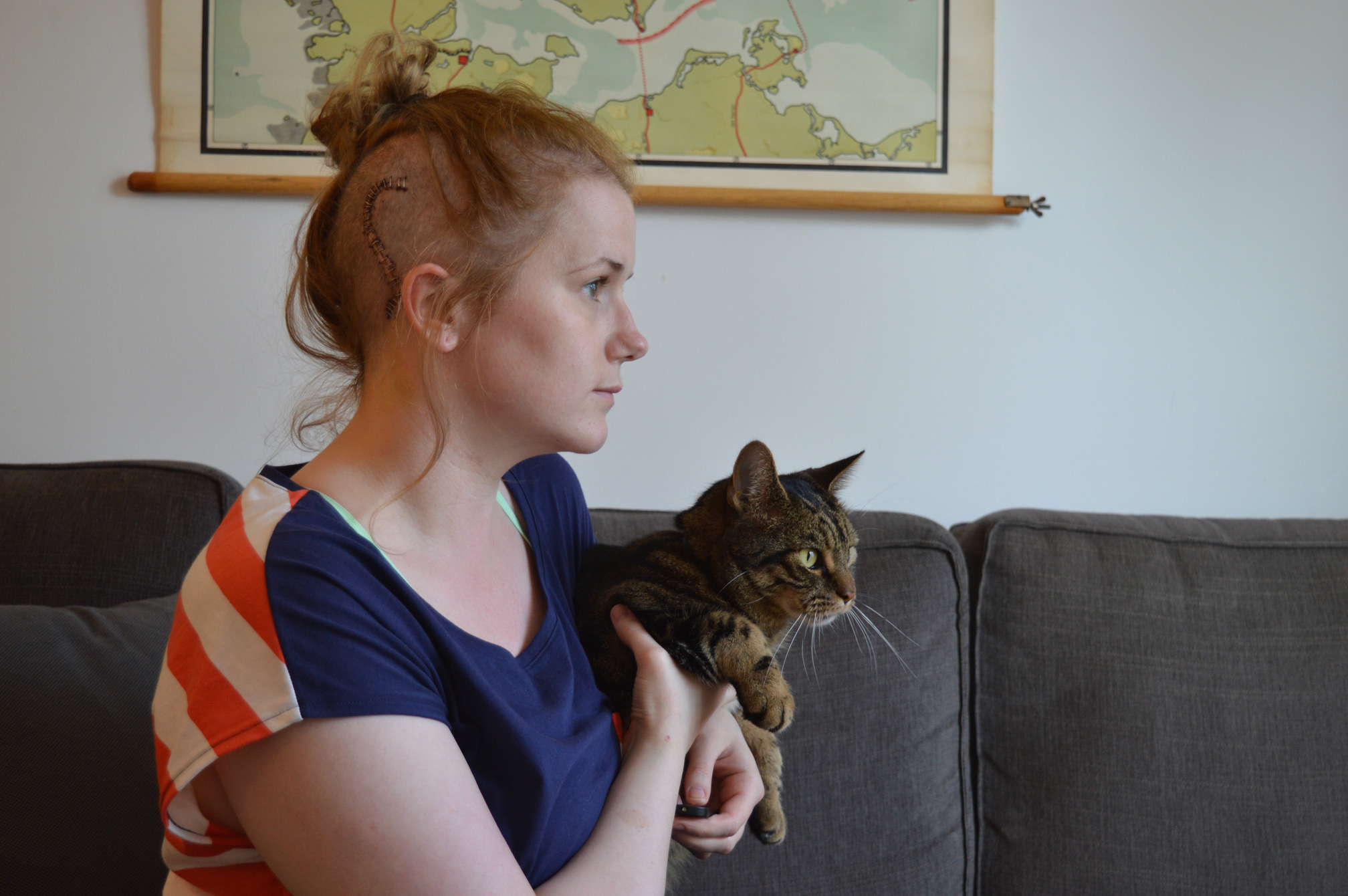 Hannah in the house - 6 months post op recovery surgery2014-2