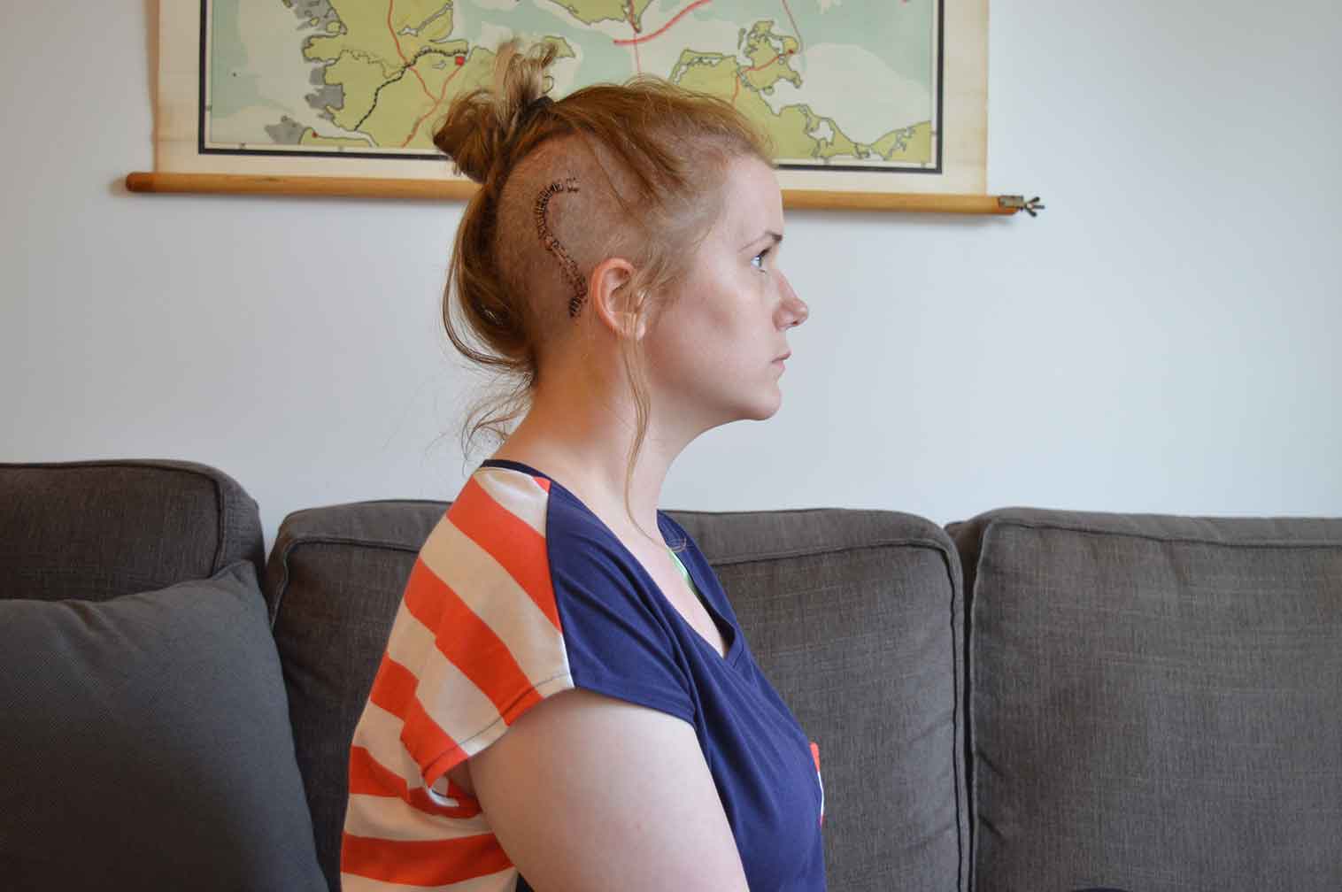 Hannah in the house - 6 months post op recovery post-op-2014-09-03-16.32.32
